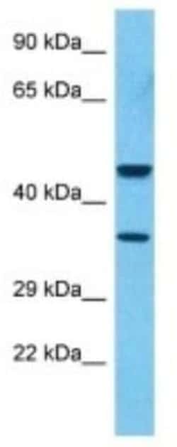 Complement Factor H-related 3/CFHR3 Rabbit anti-Human, Polyclonal, Novus